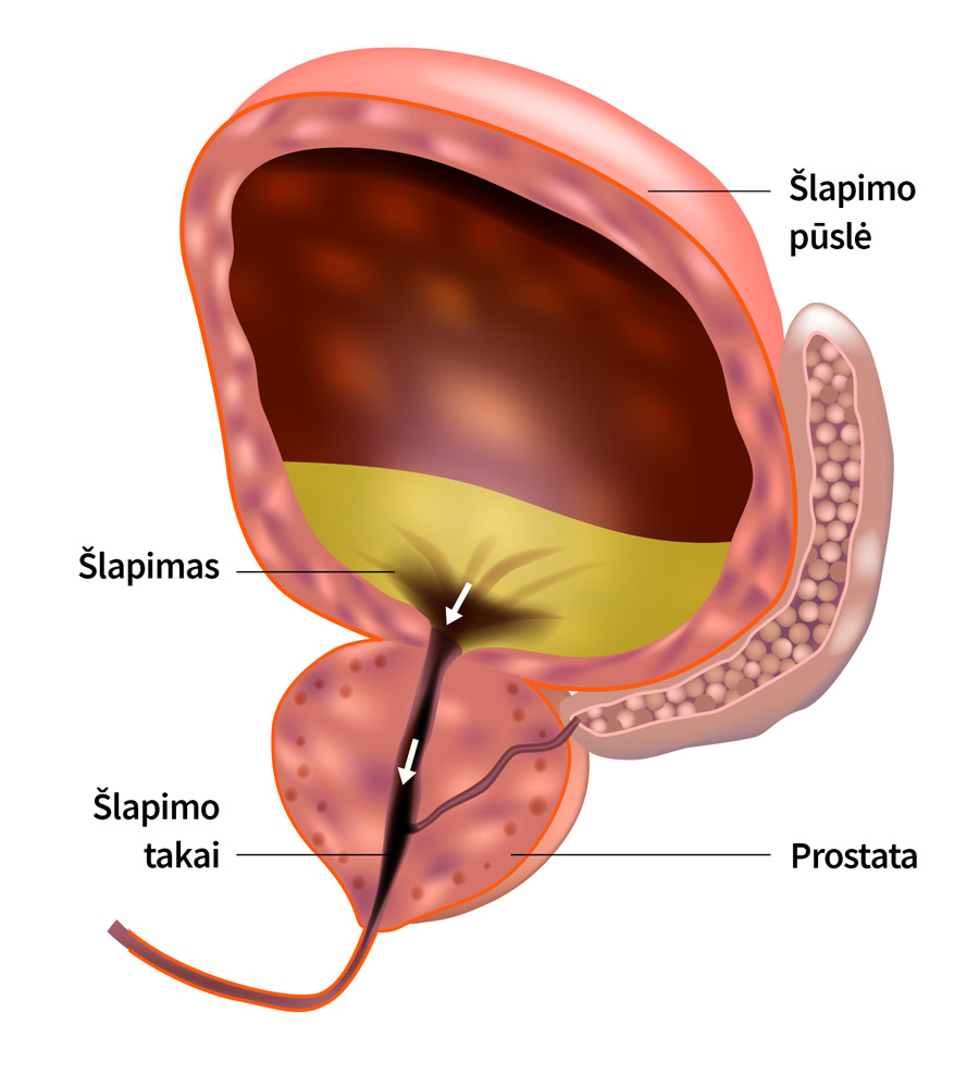 rostata yra vyrų prostatos liauka, kuri yra vyrų reprodukcinės sistemos dalis. 
